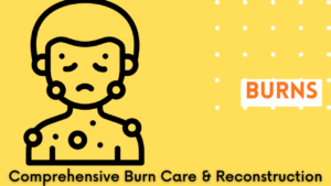 cream for burn marks