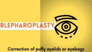 eye bags surgery treatment best for lazy eyelid