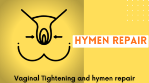 Hymenoplasty Hymen repair virgin surgery revirgination