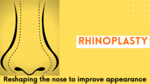 water jet rhinoplasty in india
