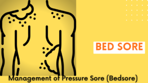 bedsore home management for bed sore at home