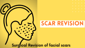 scar on face best treatment