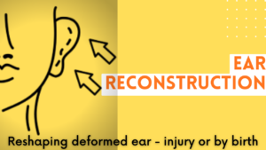 glue for ear hole