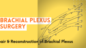 brachial plexus surgery in india
