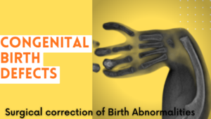 by birth hand problem best doctor nerve hand