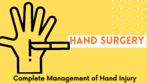 hand nerve burn problem best doctor