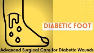 best treatment for diabetic foot in india
