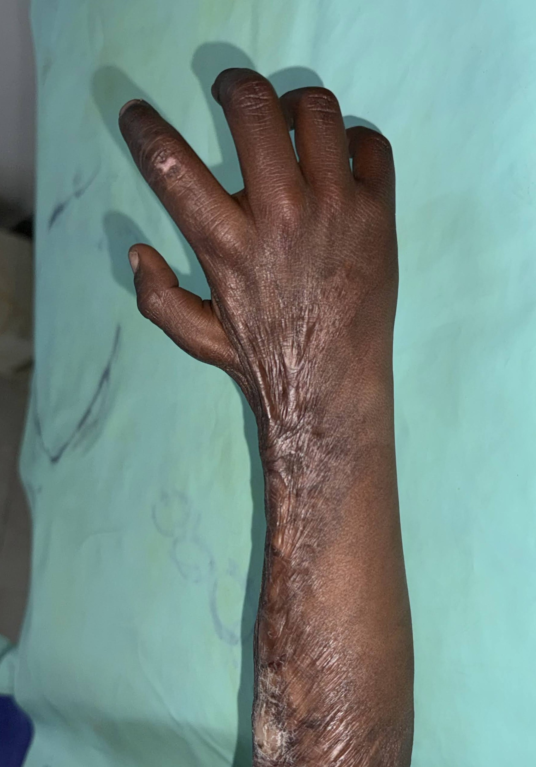 top 5 burn centers in india